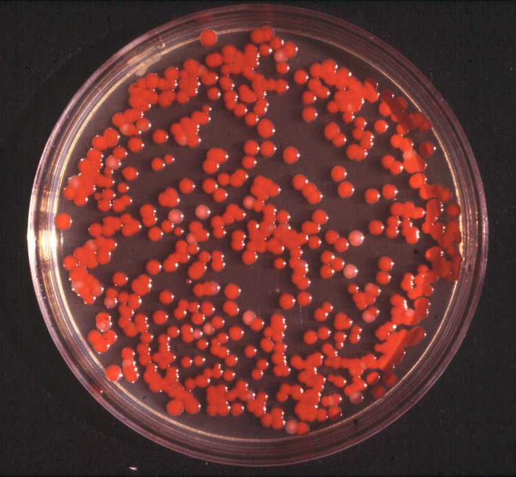 Bakterie Serratia marcescens